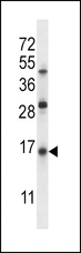 SFTPC / Surfactant Protein C Antibody - SFTPC Antibody western blot of Jurkat cell line lysates (35 ug/lane). The SFTPC antibody detected the SFTPC protein (arrow).