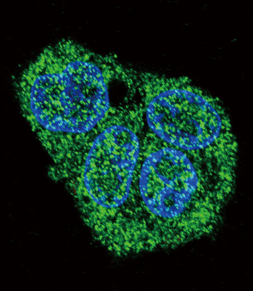 SFTPC / Surfactant Protein C Antibody - Confocal immunofluorescence of SFTPC Antibody with HepG2 cell followed by Alexa Fluor 488-conjugated goat anti-rabbit lgG (green). DAPI was used to stain the cell nuclear (blue).