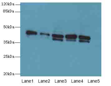 SGCA / DAG2 Antibody - Western blot. All lanes: SGCA antibody at 0.5 ug/ml. Lane 1: Jurkat whole cell lysate. Lane 2: HepG-2 whole cell lysate. Lane 3: HeLa whole cell lysate. Lane 4: 293T whole cell lysate. Lane 5: MCF7 whole cell lysate. Secondary Goat polyclonal to Rabbit IgG at 1:10000 dilution. Predicted band size: 43 kDa. Observed band size: 43 kDa.