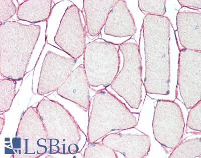 SGCA / DAG2 Antibody - Human Skeletal Muscle: Formalin-Fixed, Paraffin-Embedded (FFPE), at a concentration of 10 ug/ml. 