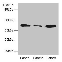 SGCA / DAG2 Antibody - Western blot All lanes: SGCA antibody at 0.5µg/ml Lane 1: Jurkat whole cell lysate Lane 2: HepG2 whole cell lysate Lane 3: Hela whole cell lysate Lane 4: 293T whole cell lysate Lane 5: MCF-7 whole cell lysate Secondary Goat polyclonal to rabbit IgG at 1/10000 dilution Predicted band size: 43, 30 kDa Observed band size: 43 kDa