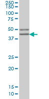 SGCB / SGC / Sarcoglycan Beta Antibody - SGCB monoclonal antibody clone 1C10 Western blot of SGCB expression in MCF-7.