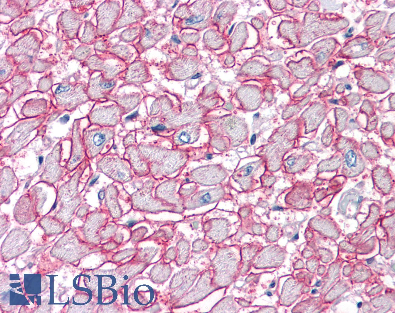 SGCB / SGC / Sarcoglycan Beta Antibody - Anti-SGCB antibody IHC of human heart. Immunohistochemistry of formalin-fixed, paraffin-embedded tissue after heat-induced antigen retrieval. Antibody concentration 5 ug/ml.