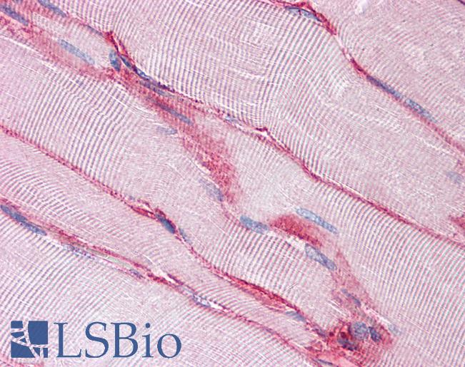 SGCB / SGC / Sarcoglycan Beta Antibody - Anti-SGCB antibody IHC of human skeletal muscle. Immunohistochemistry of formalin-fixed, paraffin-embedded tissue after heat-induced antigen retrieval. Antibody concentration 5 ug/ml.