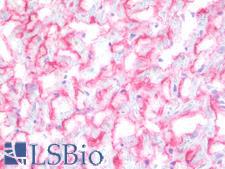 SGCB / SGC / Sarcoglycan Beta Antibody - IHC with SGCB antibody on frozen human heart. 