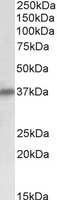 SGCD / Delta-Sarcoglycan Antibody - SGCD antibody (0.1 ug/ml) staining of Human Heart lysate (35 ug protein/ml in RIPA buffer). Primary incubation was 1 hour. Detected by chemiluminescence.