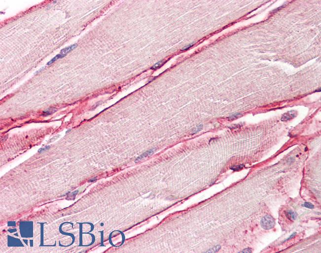SGCD / Delta-Sarcoglycan Antibody - Anti-SGCD / Delta-Sarcoglycan antibody IHC of human skeletal muscle. Immunohistochemistry of formalin-fixed, paraffin-embedded tissue after heat-induced antigen retrieval. Antibody dilution 3.75 ug/ml.