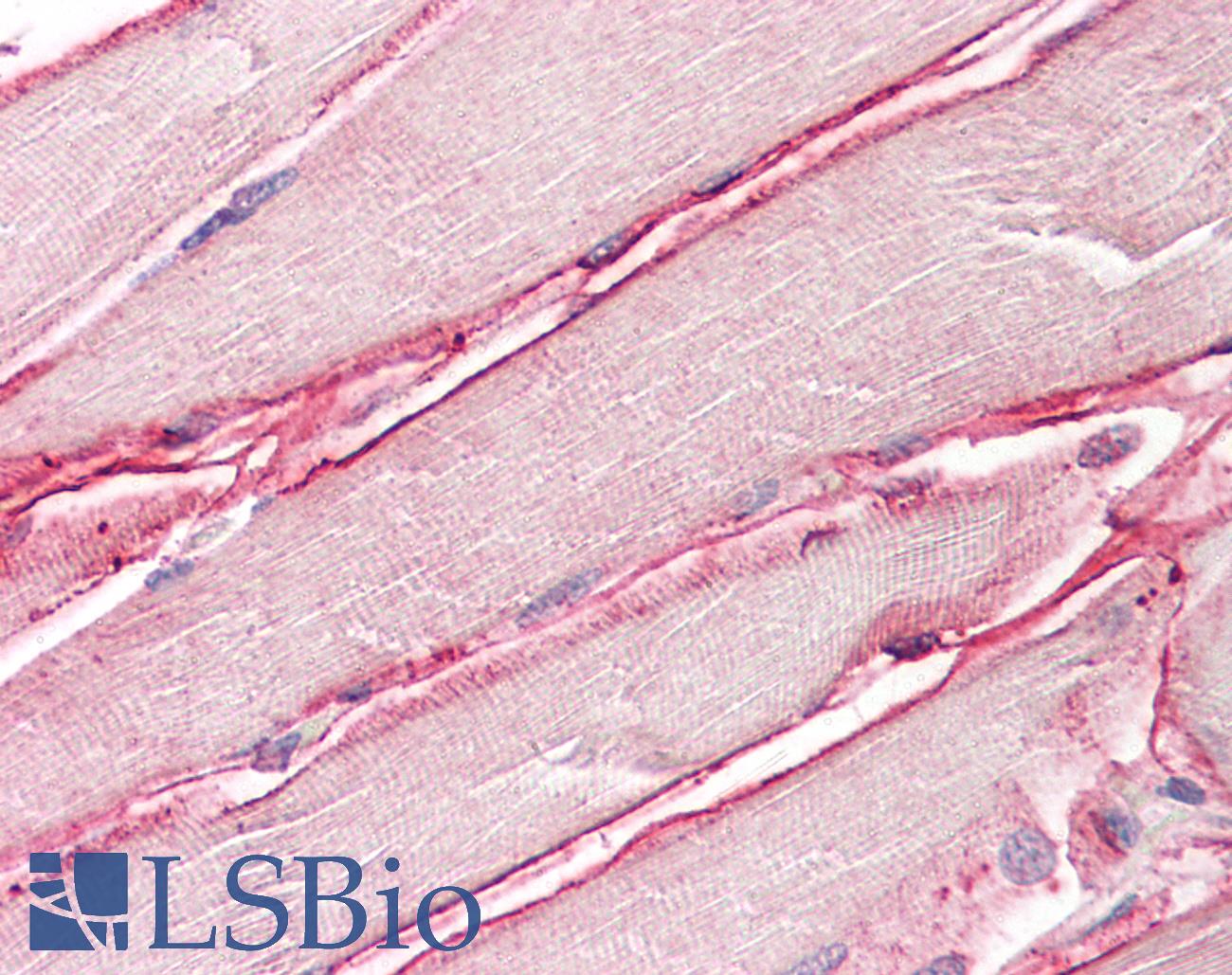 SGCD / Delta-Sarcoglycan Antibody - Anti-SGCD / Delta-Sarcoglycan antibody IHC of human skeletal muscle. Immunohistochemistry of formalin-fixed, paraffin-embedded tissue after heat-induced antigen retrieval. Antibody dilution 3.75 ug/ml.