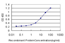 SGK1 / SGK Antibody - Detection limit for recombinant GST tagged SGK is approximately 0.3 ng/ml as a capture antibody.