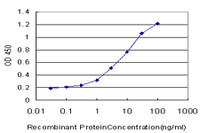 SGK1 / SGK Antibody - Detection limit for recombinant GST tagged SGK is approximately 0.03 ng/ml as a capture antibody.