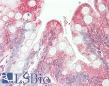 SGPL1 Antibody - Anti-SGPL1 antibody IHC staining of human small intestine. Immunohistochemistry of formalin-fixed, paraffin-embedded tissue after heat-induced antigen retrieval. Antibody dilution 1:75.