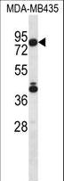 SGPL1 Antibody - SGPL1 Antibody western blot of MDA-MB435 cell line lysates (35 ug/lane). The SGPL1 antibody detected the SGPL1 protein (arrow).