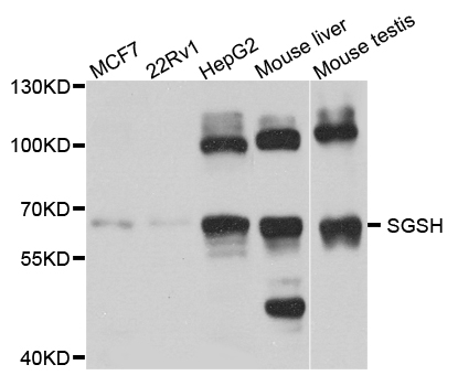SGSH Antibody - Western blot blot of extract of various cells, using SGSH antibody.