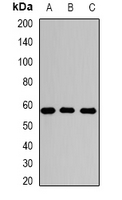 SGSH Antibody - Western blot analysis of Sulphamidase expression in HepG2 (A); mouse liver (B); mouse testis (C) whole cell lysates.