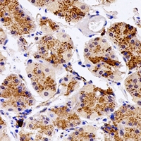 SGSH Antibody - Immunohistochemical analysis of Sulphamidase staining in human stomach formalin fixed paraffin embedded tissue section. The section was pre-treated using heat mediated antigen retrieval with sodium citrate buffer (pH 6.0). The section was then incubated with the antibody at room temperature and detected using an HRP conjugated compact polymer system. DAB was used as the chromogen. The section was then counterstained with hematoxylin and mounted with DPX.