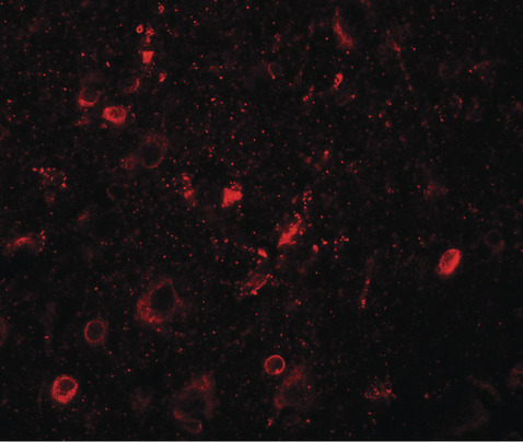 SGSM1 Antibody - Immunofluorescence of SGSM1 in human brain tissue with SGSM1 antibody at 20 ug/ml.