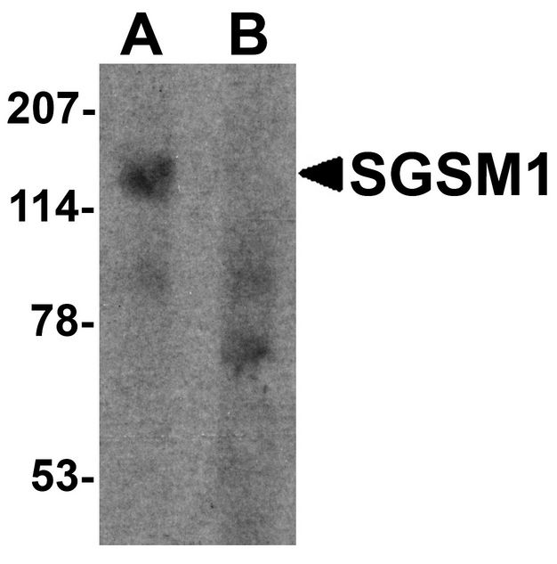SGSM1 Antibody - Western blot analysis of SGSM1 in human cerebellum tissue lysate with SGSM1 antibody at 1 ug/ml in (A) the absence and (B) the presence of blocking peptide.