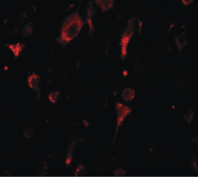 SGSM2 Antibody - Immunofluorescence of SGSM2 in human brain tissue with SGSM2 antibody at 20 ug/ml.