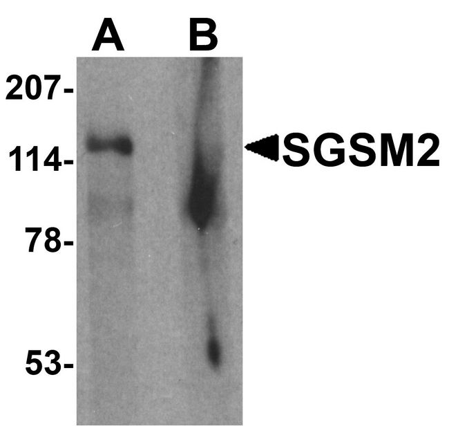 SGSM2 Antibody - Western blot analysis of SGSM2 in human cerebellum tissue lysate with SGSM2 antibody at 1 ug/ml in (A) the absence and (B) the presence of blocking peptide