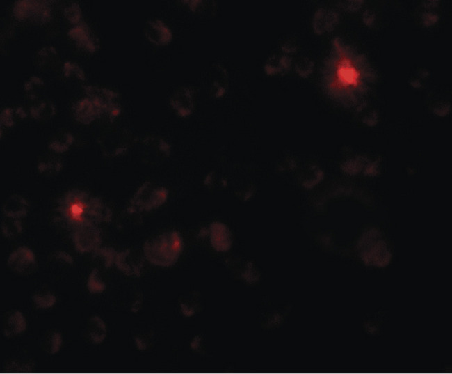 SGSM3 Antibody - Immunofluorescence of SGSM3 in 293 cells with SGSM3 antibody at 20 ug/ml.
