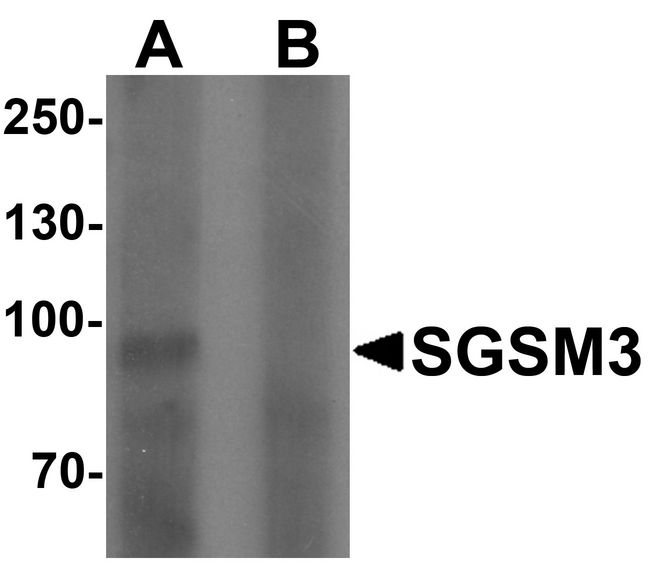 SGSM3 Antibody - Western blot analysis of SGSM3 in 293 cell lysate with SGSM3 antibody at (A) 1 and (B) 2 ug/ml.