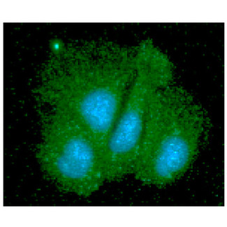 SGTA / SGT Antibody - ICC/IF analysis of SGTA in Hep3B cells line, stained with DAPI (Blue) for nucleus staining and monoclonal anti-human SGTA antibody (1:100) with goat anti-mouse IgG-Alexa fluor 488 conjugate (Green).