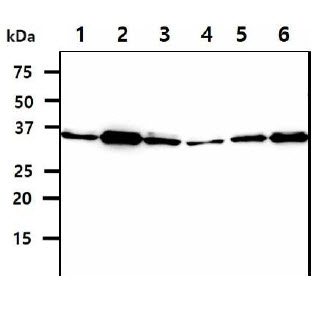 SGTA / SGT Antibody - The cell lysates (40ug) were resolved by SDS-PAGE, transferred to PVDF membrane and probed with anti-human SGTA antibody (1:1000). Proteins were visualized using a goat anti-mouse secondary antibody conjugated to HRP and an ECL detection system. Lane 1.: HeLa cell lysate Lane 2.: K562 cell lysate Lane 3.: A549 cell lysate Lane 4.: MCF7 cell lysate Lane 5.: LNCaP cell lysate Lane 6.: 293T cell lysate