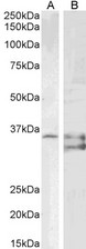 SGTA / SGT Antibody - Goat anti-Sgta (mouse aa84-97) Antibody (1ug/ml) staining of PD19 (A) and (2µg/ml) K562 (B) cell lysate (35µg protein in RIPA buffer). Detected by chemiluminescencence.