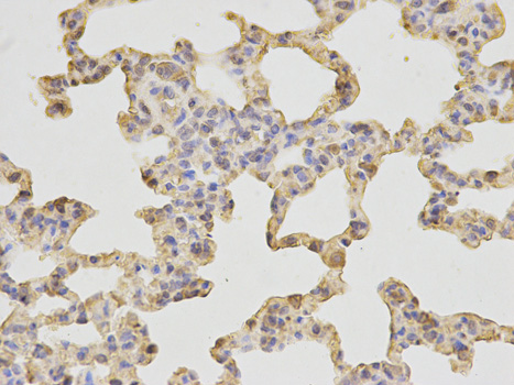 SH2D1A / SAP Antibody - Immunohistochemistry of paraffin-embedded rat lung using SH2D1A antibody at dilution of 1:200 (400x lens).