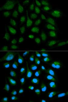 SH2D1A / SAP Antibody - Immunofluorescence analysis of HeLa cell using SH2D1A antibody. Blue: DAPI for nuclear staining.