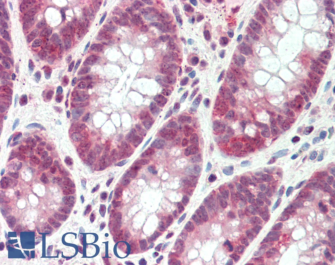SH2D3A / NSP1 Antibody - Anti-SH2D3A / NSP1 antibody IHC staining of human colon. Immunohistochemistry of formalin-fixed, paraffin-embedded tissue after heat-induced antigen retrieval. Antibody concentration 5 ug/ml.