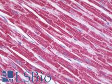 SH3BGR Antibody - Anti-SH3BGR antibody IHC staining of human heart. Immunohistochemistry of formalin-fixed, paraffin-embedded tissue after heat-induced antigen retrieval. Antibody dilution 1:100.