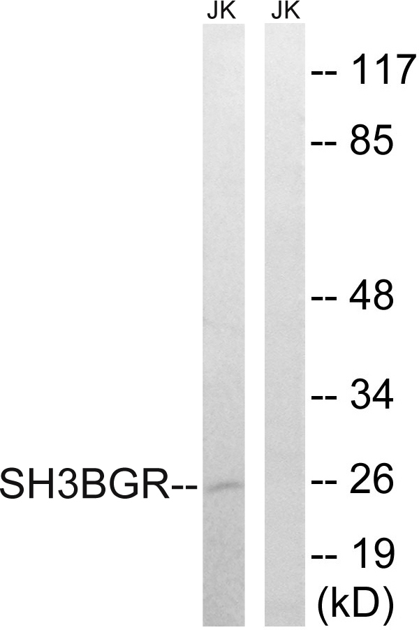 SH3BGR Antibody - Western blot analysis of lysates from Jurkat cells, using SH3BGR Antibody. The lane on the right is blocked with the synthesized peptide.