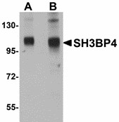 SH3BP4 Antibody - Western blot of SH3BP4 in rat lung tissue lysate with SH3BP4 antibody at (A) 1 and (B) 2 ug/ml.