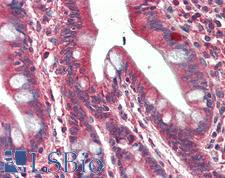 SH3GL1 / EEN Antibody - Human, Small intestine: Formalin-Fixed Paraffin-Embedded (FFPE)