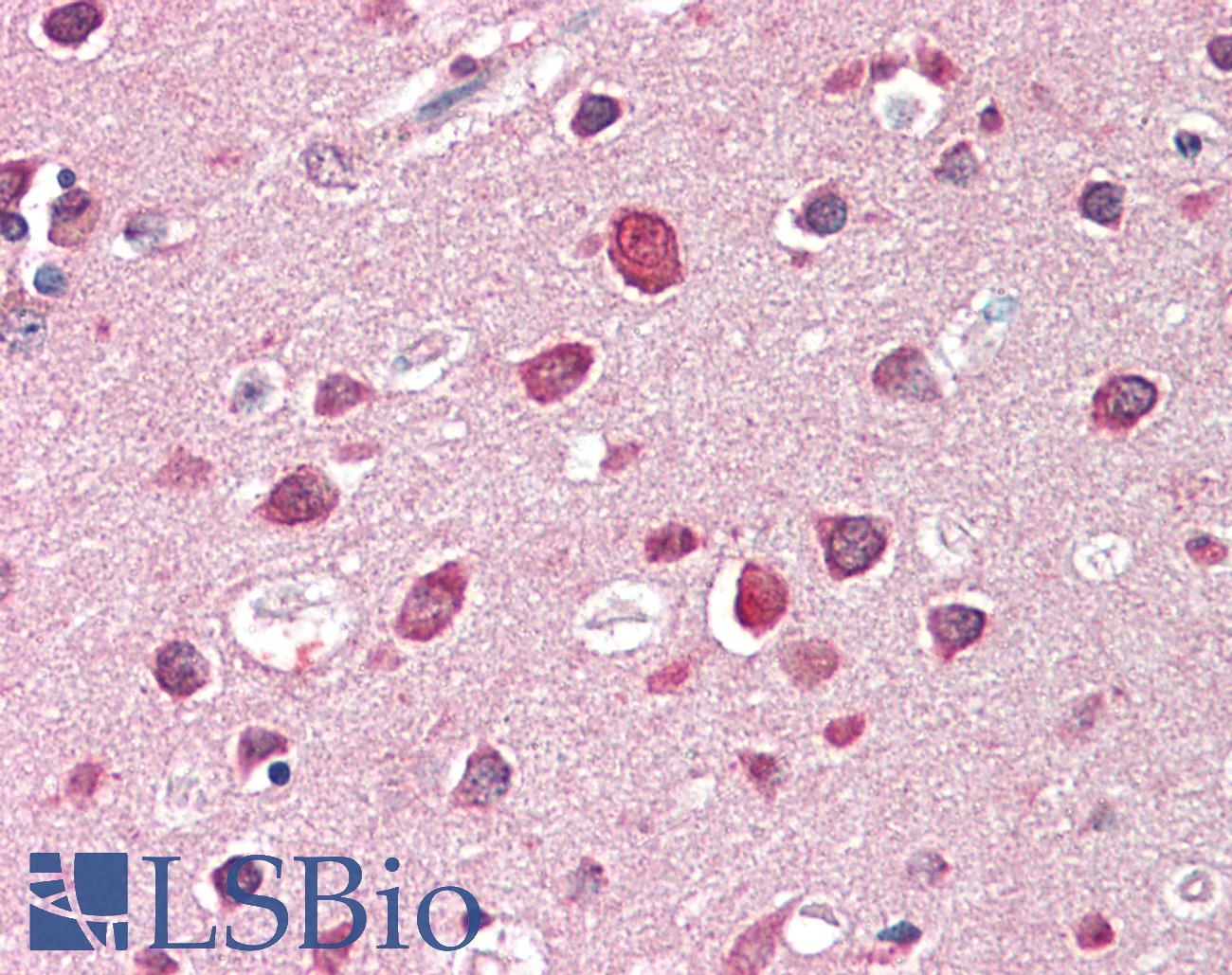 SH3GL2 Antibody - Anti-SH3GL2 antibody IHC staining of human brain, cortex. Immunohistochemistry of formalin-fixed, paraffin-embedded tissue after heat-induced antigen retrieval. Antibody concentration 5 ug/ml.