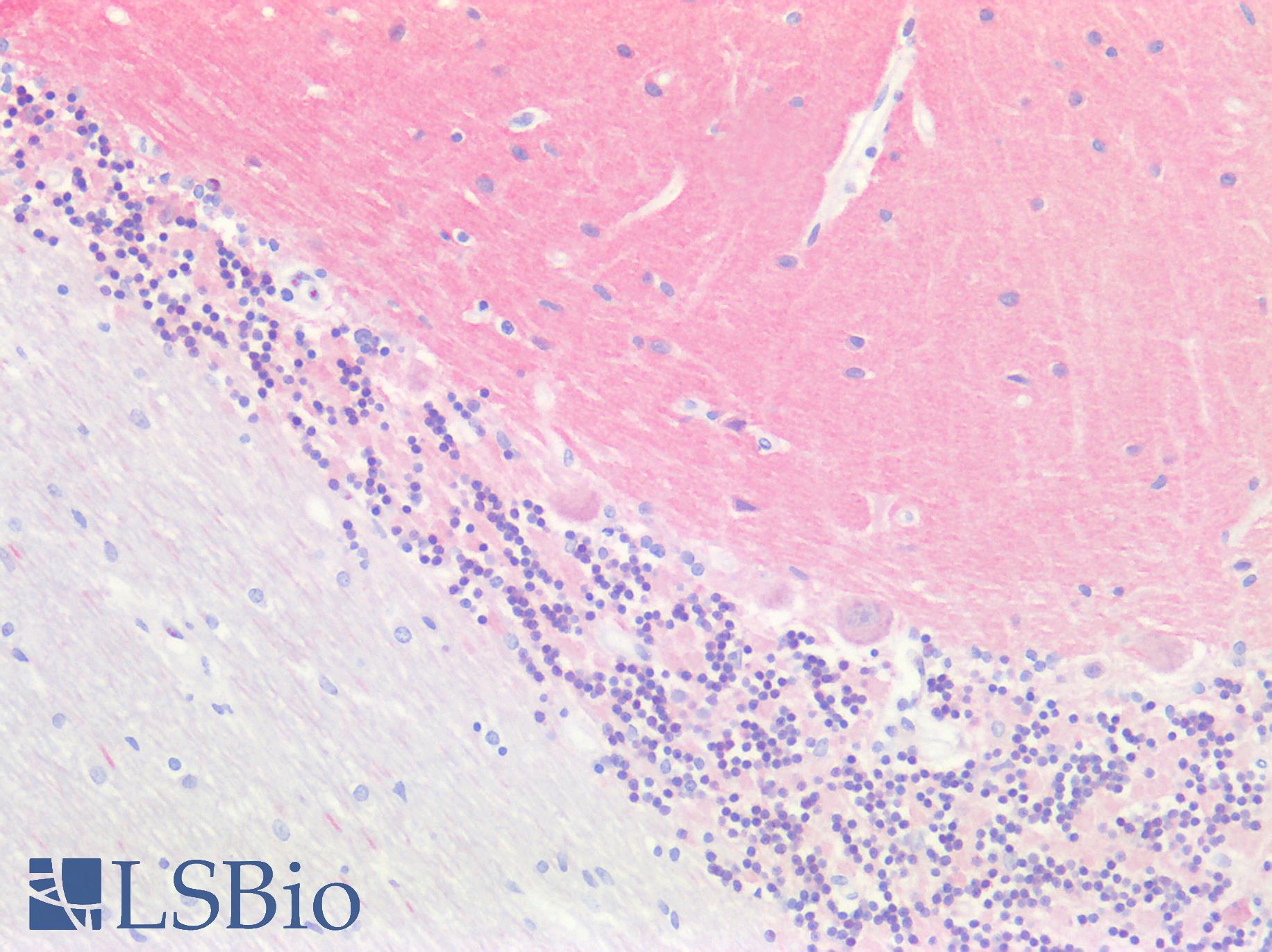 SH3GL2 Antibody - Human Cerebellum: Formalin-Fixed, Paraffin-Embedded (FFPE)