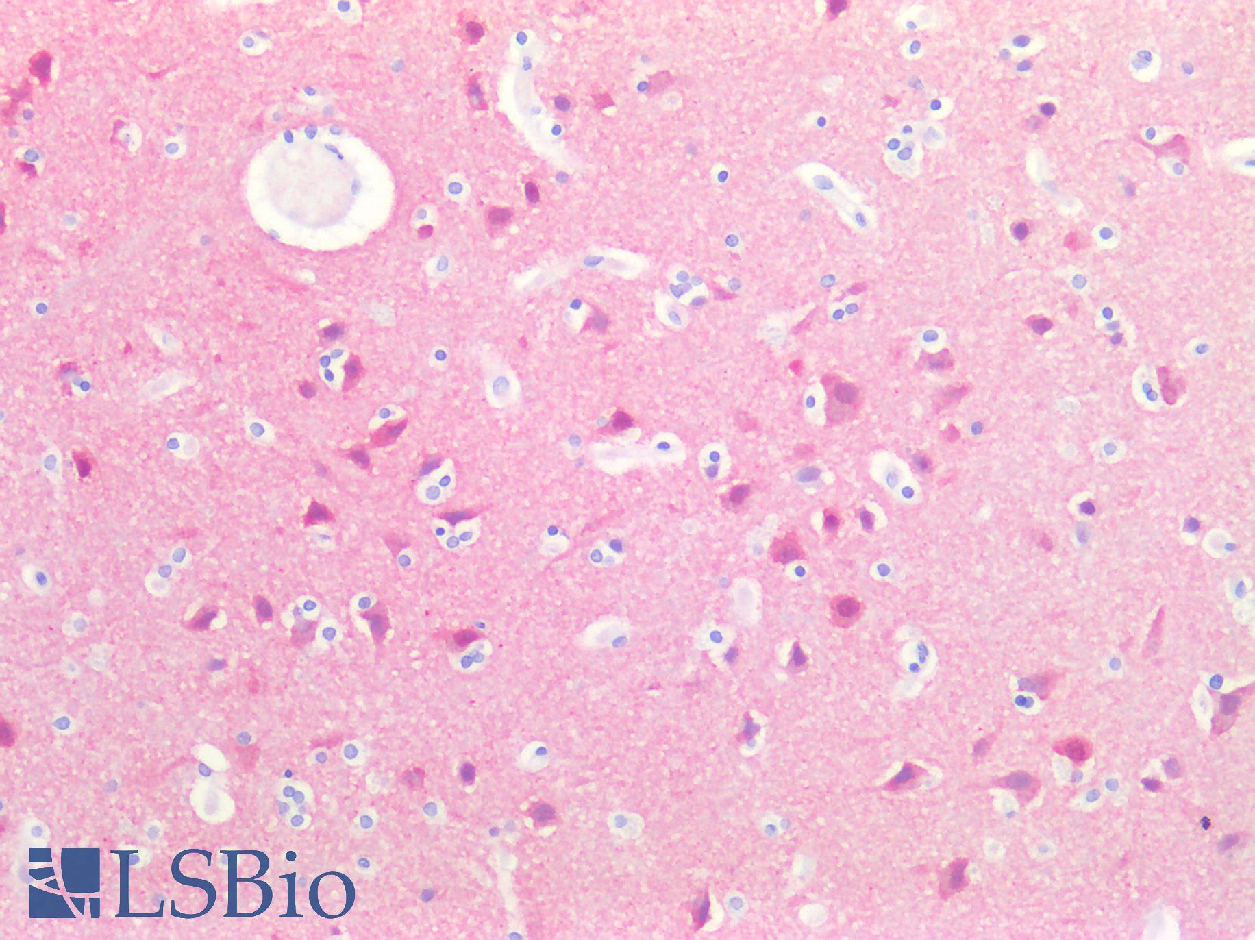 SH3GL2 Antibody - Human Brain, Cortex: Formalin-Fixed, Paraffin-Embedded (FFPE)