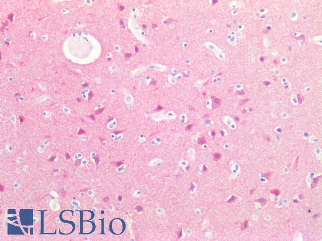 SH3GL2 Antibody - Human Brain, Cortex: Formalin-Fixed, Paraffin-Embedded (FFPE)