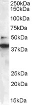 SH3GLB1 / Bif / Endophilin B1 Antibody - Staining (0.3 ug/ml) of Jurkat lysate (RIPA buffer, 35 ug total protein per lane). Primary incubated for 1 hour. Detected by chemiluminescence.