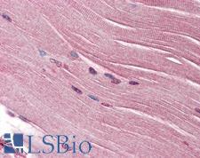SH3GLB1 / Bif / Endophilin B1 Antibody - Anti-SH3GLB1 / Bif-1 antibody IHC of human skeletal muscle. Immunohistochemistry of formalin-fixed, paraffin-embedded tissue after heat-induced antigen retrieval. Antibody concentration 5 ug/ml.