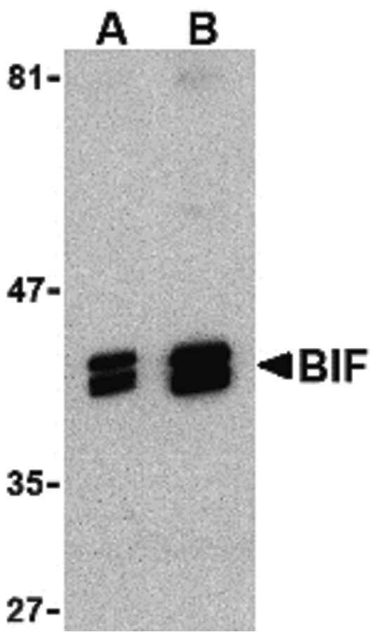 SH3GLB1 / Bif / Endophilin B1 Antibody - Western blot of BIF in HeLa cell lysate with BIF antibody at (A) 1 and (B) 2 ug/ml.