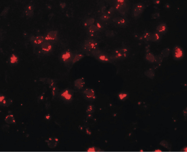 SH3RF2 Antibody - Immunofluorescence of SH3RF2 in human brain tissue with SH3RF2 antibody at 20 ug/ml.