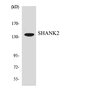 SHANK2 / SHANK Antibody - Western blot analysis of the lysates from HT-29 cells using SHANK2 antibody.