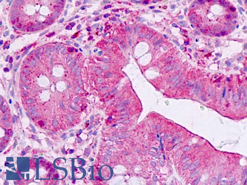 SHANK2 / SHANK Antibody - Anti-SHANK2 / SHANK antibody IHC staining of human intestine. Immunohistochemistry of formalin-fixed, paraffin-embedded tissue after heat-induced antigen retrieval.