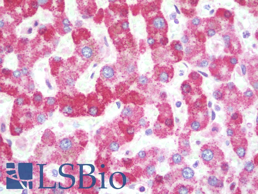 SHBG Antibody - Anti-SHBG antibody IHC staining of human liver. Immunohistochemistry of formalin-fixed, paraffin-embedded tissue after heat-induced antigen retrieval. Antibody concentration 10 ug/ml.