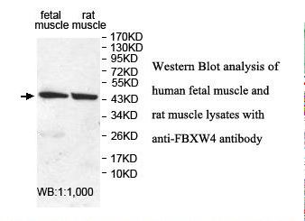 SHFM3 / FBXW4 Antibody