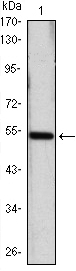 SHH / Sonic Hedgehog Antibody - Western blot using SHH monoclonal antibody against SHH(AA: 26-161)-hIgGFc transfected HEK293 cell lysate.