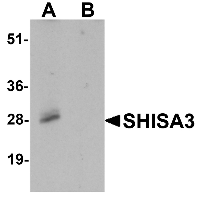 SHISA3 Antibody - Western blot analysis of SHISA3 in human small intestine Tissue lysate with SHISA3 antibody at 1 ug/ml in (A) the absence and (B) the presence of blocking peptide.