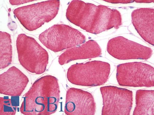 SHISA3 Antibody - Anti-SHISA3 antibody IHC staining of human skeletal muscle. Immunohistochemistry of formalin-fixed, paraffin-embedded tissue after heat-induced antigen retrieval.